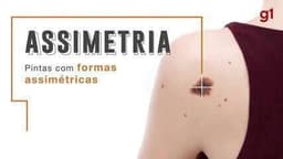 Centro de Oncologia Campinas realiza exames gratuitos para diagnóstico de câncer de pele. Reprodução: Globo