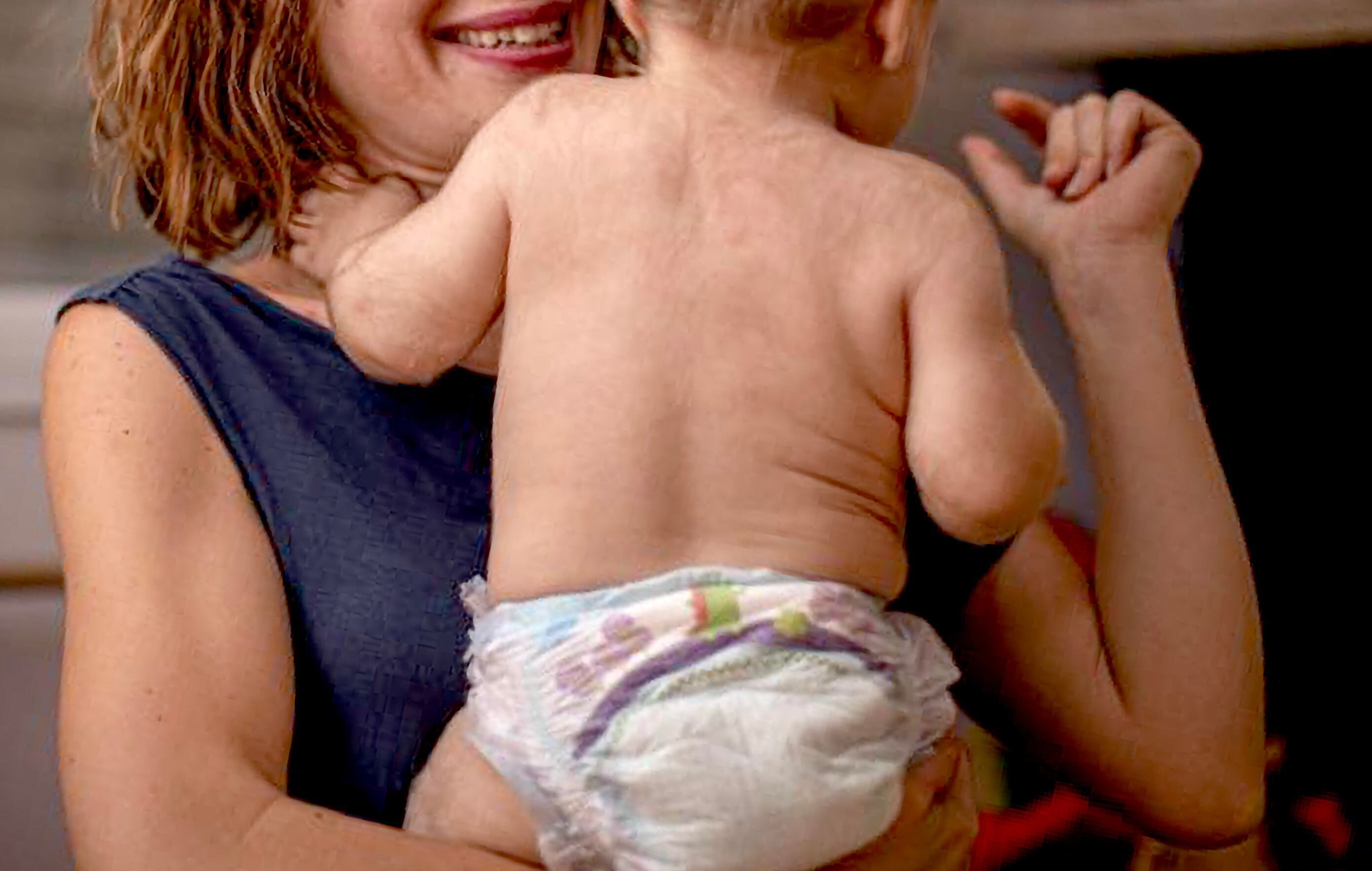 Procuradoria pede absolvição dos acusados no caso de 21 menores com síndrome do homem-lobo.. Reprodução: Elpais