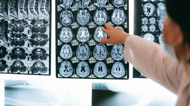 Mecanismo cerebral ajuda a superar o medo em animais