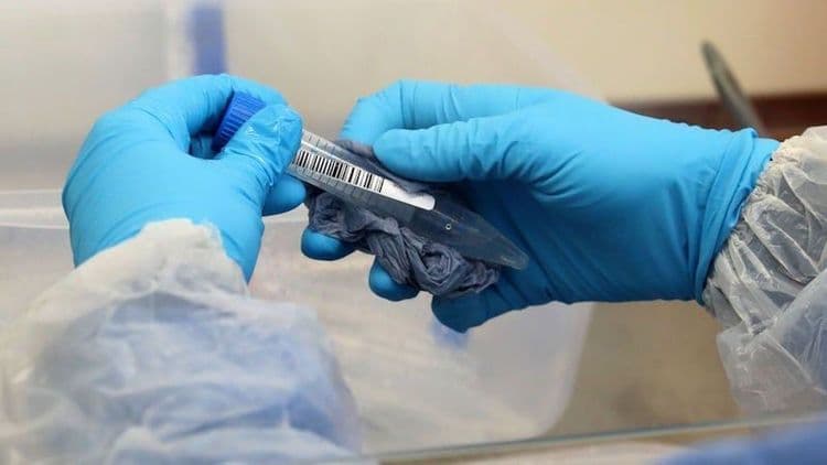 Novo dispositivo chamado Elsa promete revolucionar o setor, segundo a FDA.; Reprodução: Gizmodo