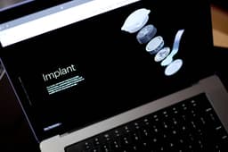 Experimento da Neuralink permite que macaco 'enxergue' imagens geradas por um implante cerebral. Reprodução: Globo