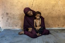 Crianças palestinas enfrentam grave desnutrição em meio à crise alimentar em Gaza. Reprodução: Globo