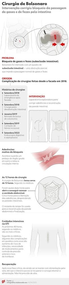 Bolsonaro enfrenta nova obstrução intestinal após cirurgias anteriores. Reprodução: Globo